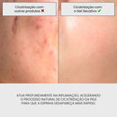 Gel Secativo | Película Invisível